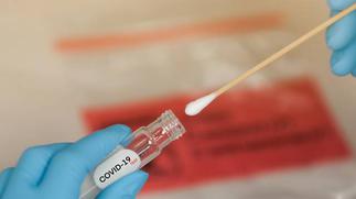 COVID-19: UHAS offers walk-in COVID-19 testing procedures