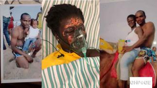 Man who bathed his wife with acid jailed for 10 years