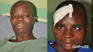 37 Military Hospital in search of families of 2 hospitalized accident victims