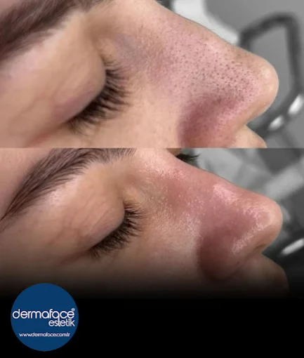 Dermaface Güzellik Salonu — İzmir