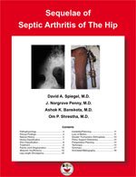 Sequelae Of Septic Arthritis Of The Hip