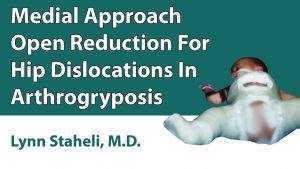 Medial Approach Open Reduction For Hip Dislocations In Arthrogryposis