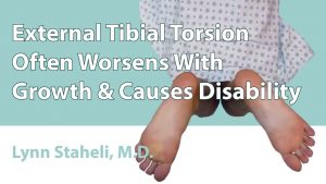 External Tibial Torsion Often Worsens With Growth & Causes Disability