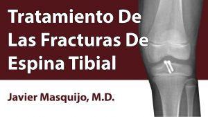 Tratamiento De Las Fracturas De Espina Tibial