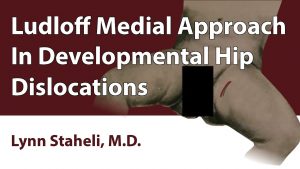 Ludloff Medial Approach In Developmental Hip Dislocations