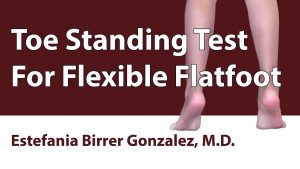 Toe Standing Test For Flexible Flatfoot