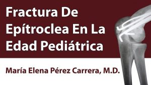 Fractura De Epítroclea En La Edad Pediátrica