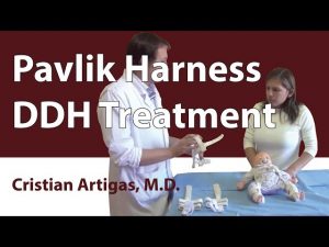 Pavlik Harness DDH Treatment