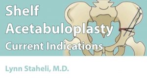 Shelf Acetabuloplasty (Current Indications)