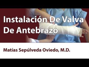 Instalación De Valva De Antebrazo