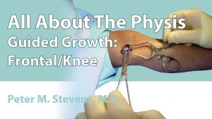 Guided Growth: Frontal/Knee