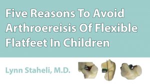 Five Reasons To Avoid Arthroereisis Of Flexible Flatfeet In Children