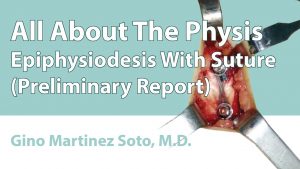 Epiphysiodesis With Suture (Preliminary Report)