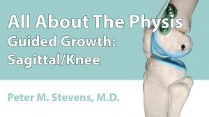 Guided Growth: Sagittal/Knee