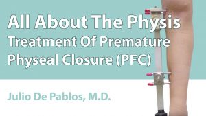 Treatment Of Premature Physeal Closure (PFC)