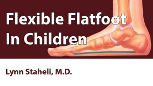 Flexible Flatfoot In Children