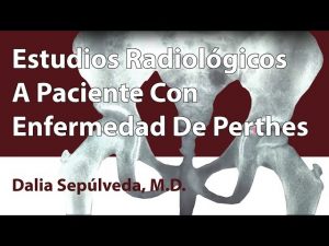 Estudios Radiológicos A Paciente Con Enfermedad De Perthes