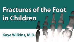 Fractures Of The Foot In Children