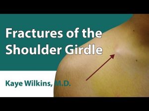 Fractures Of The Shoulder Girdle