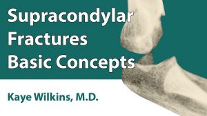 Supracondylar Fractures: Basic Concepts