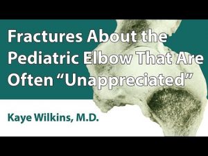 Fractures About The Pediatric Elbow That Are Often "Unappreciated"