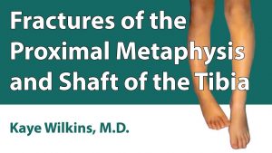 Fractures Of The Proximal Metaphysis & Shaft Of The Tibia