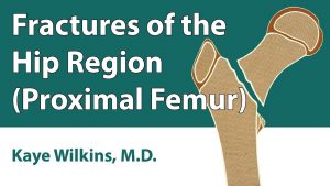 Fractures Of The Hip Region (Proximal Femur)