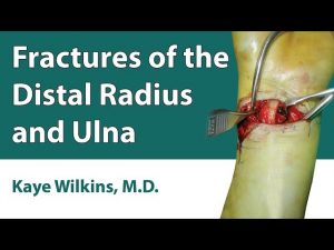 Fractures Of The Distal Radius & Ulna