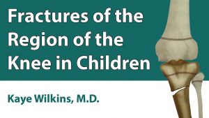 Fractures Of The Region Of The Knee In Children