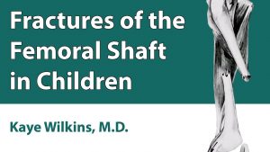 Fractures Of The Femoral Shaft In Children