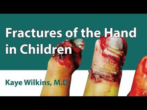 Fractures Of The Hand In Children