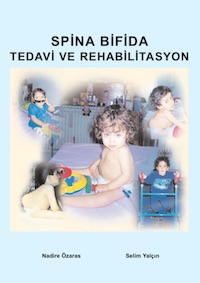 Spina Bifida: Treatment & Rehabilitation