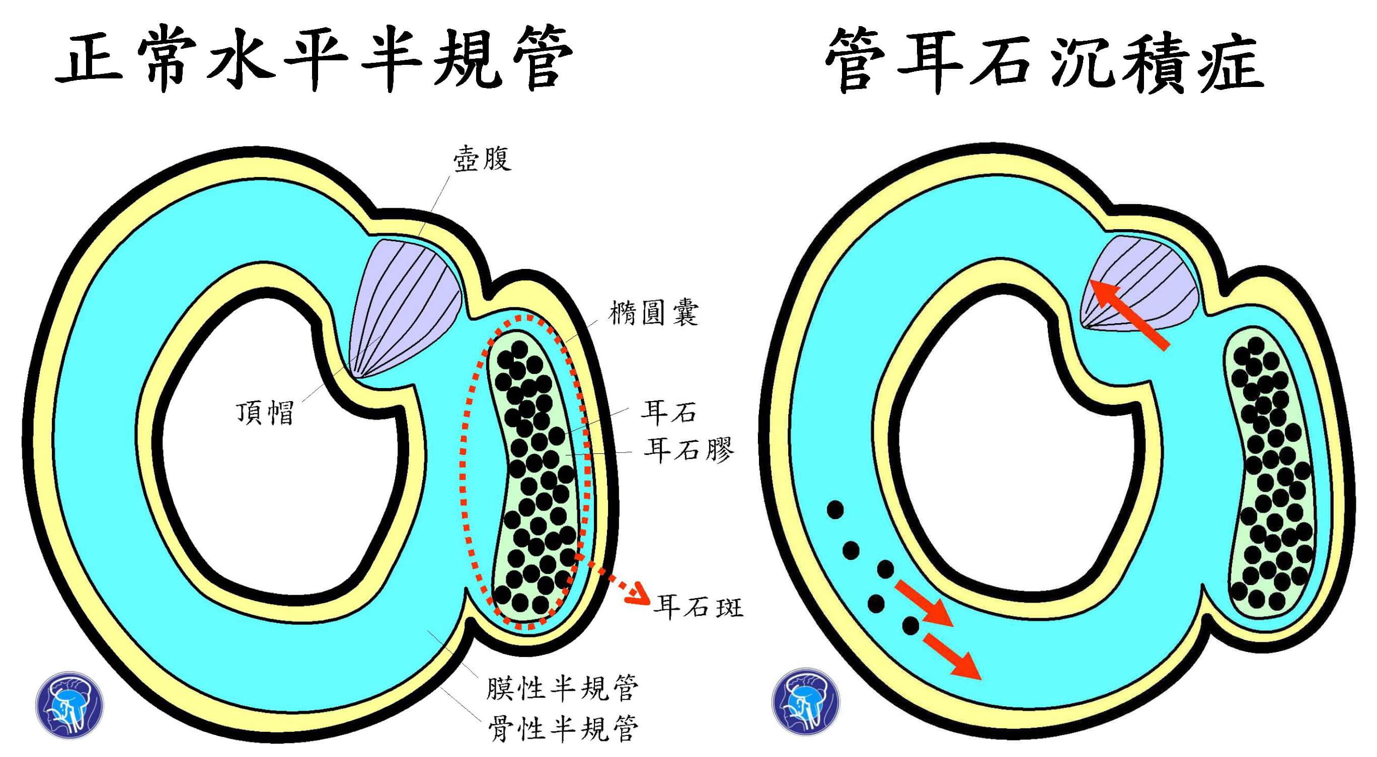 （圖／翻攝自今健康）