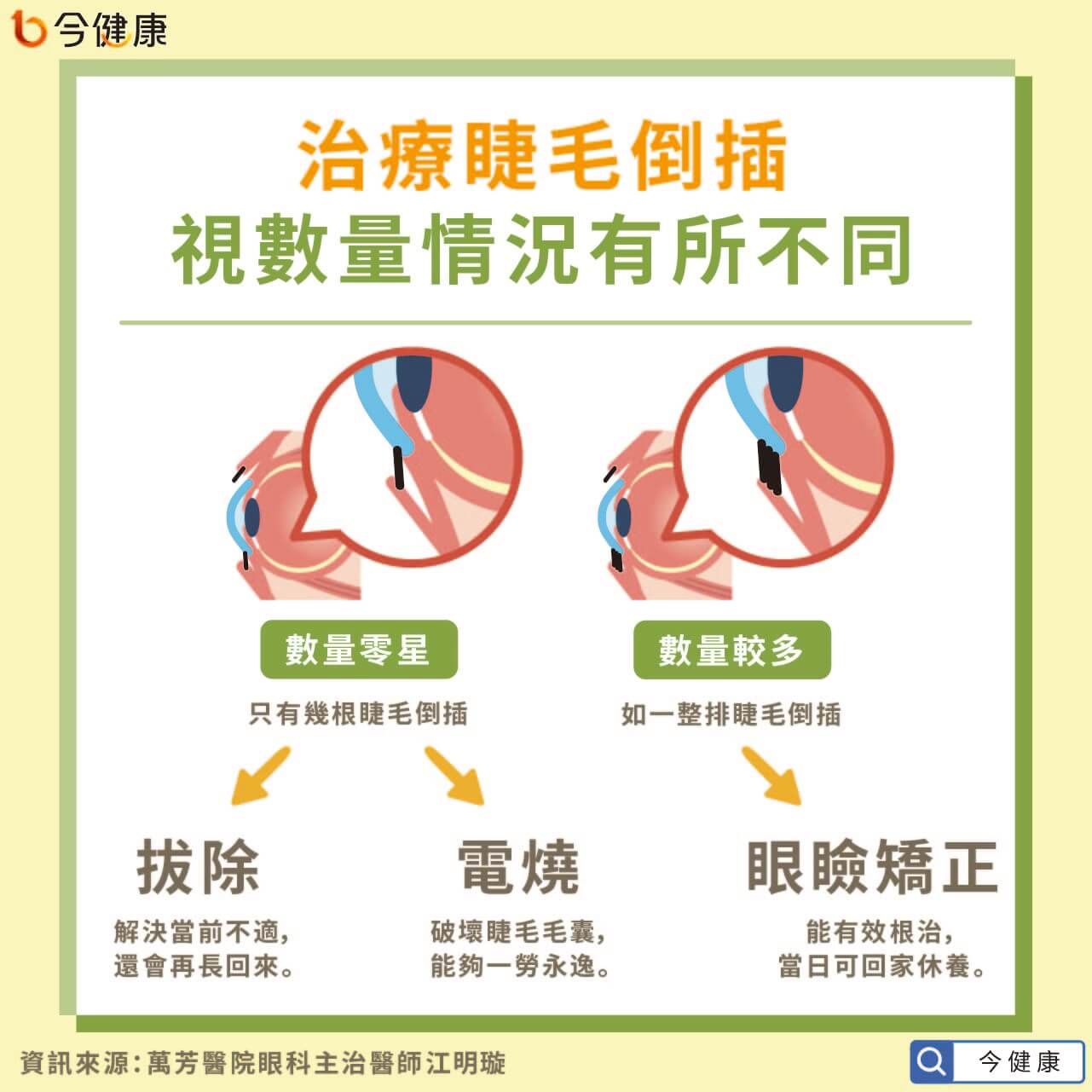 反覆眼痛竟是睫毛倒插醫指常見症狀 長期恐視力模糊 今健康