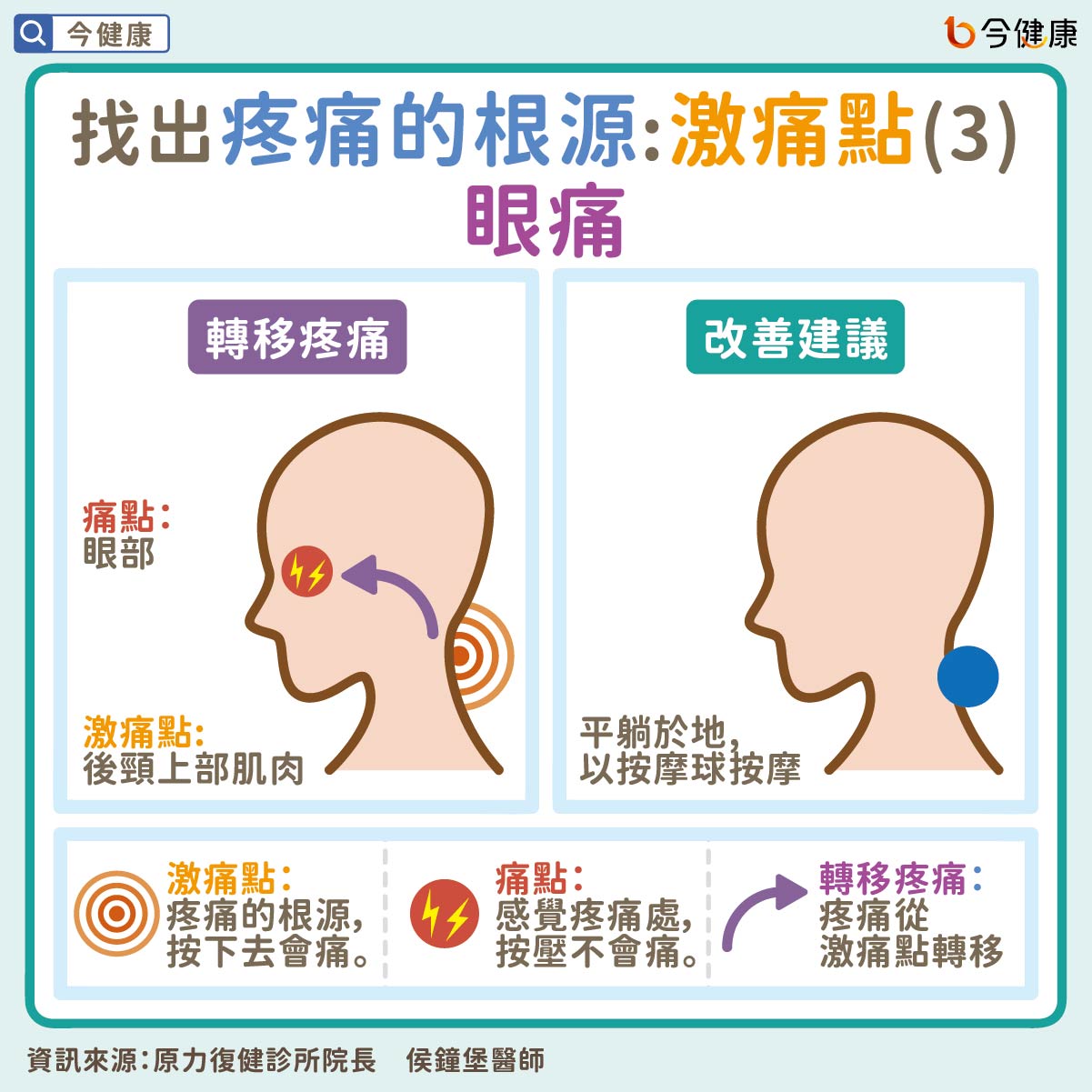 #頭痛 #眼痛 #頭頂痛 #太陽穴 #前額 #膝蓋 #激痛點