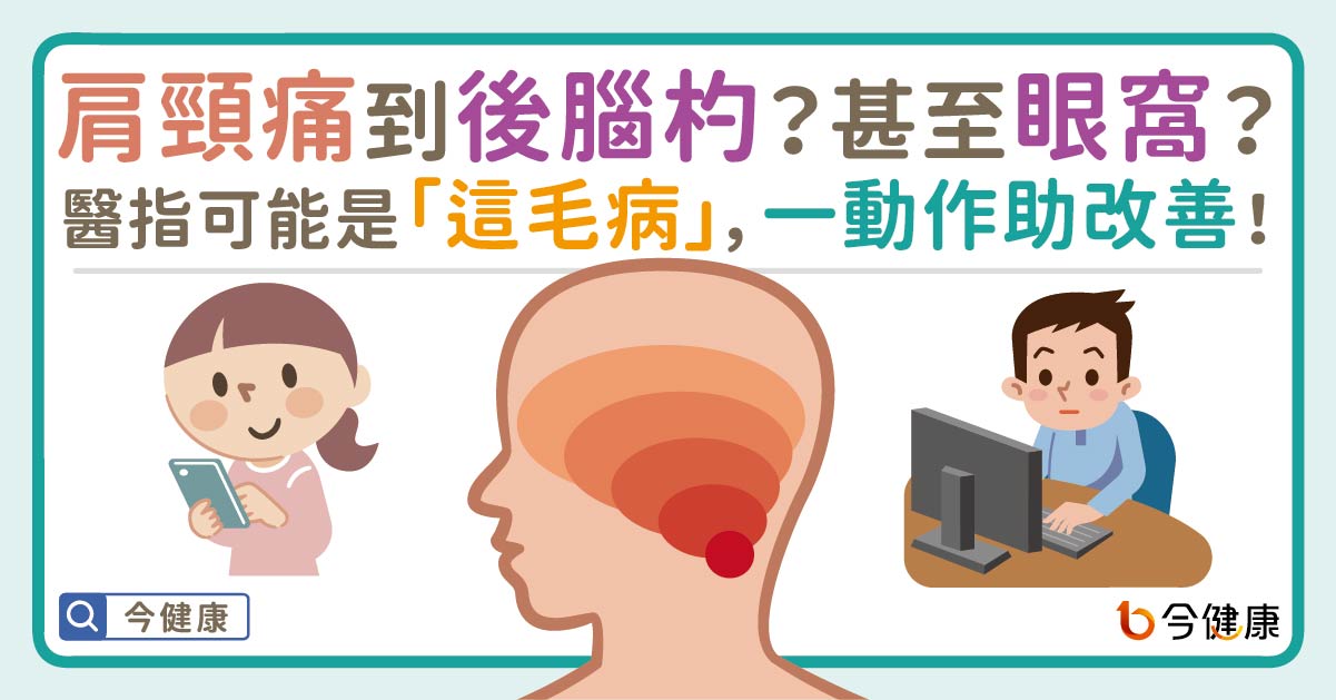 肩頸痛到後腦杓？甚至眼窩？醫指可能是「這毛病」，一動作助改善！