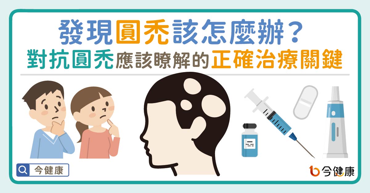 發現圓禿該怎麼辦？對抗圓禿應該瞭解的正確治療關鍵