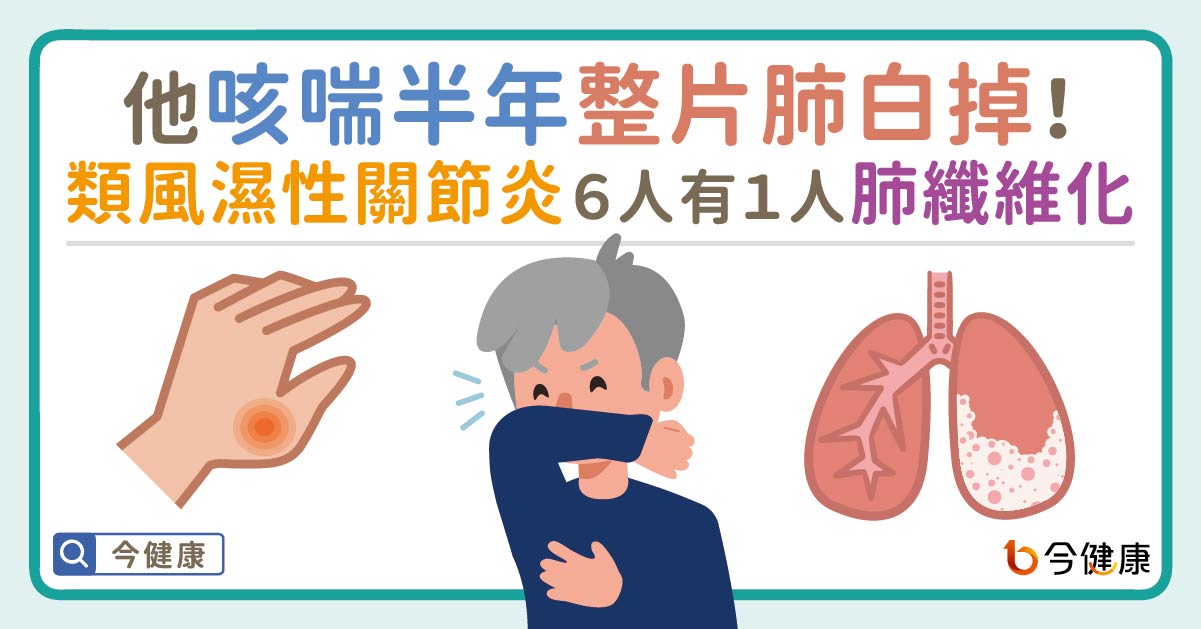 近6位類風濕性關節炎患者就有1人肺纖維化   持續咳喘半年後檢查肺部整片白掉