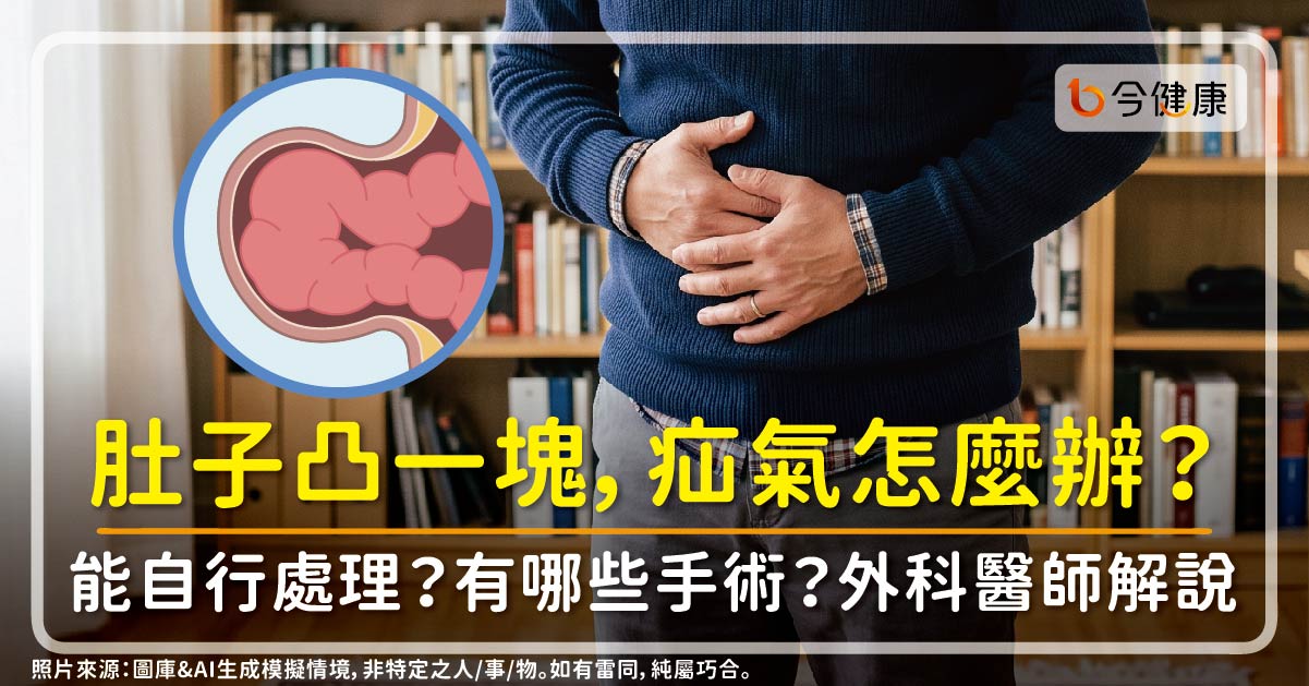 肚子凸一塊，疝氣怎麼辦？能自行處理？有哪些手術？外科醫師解說！