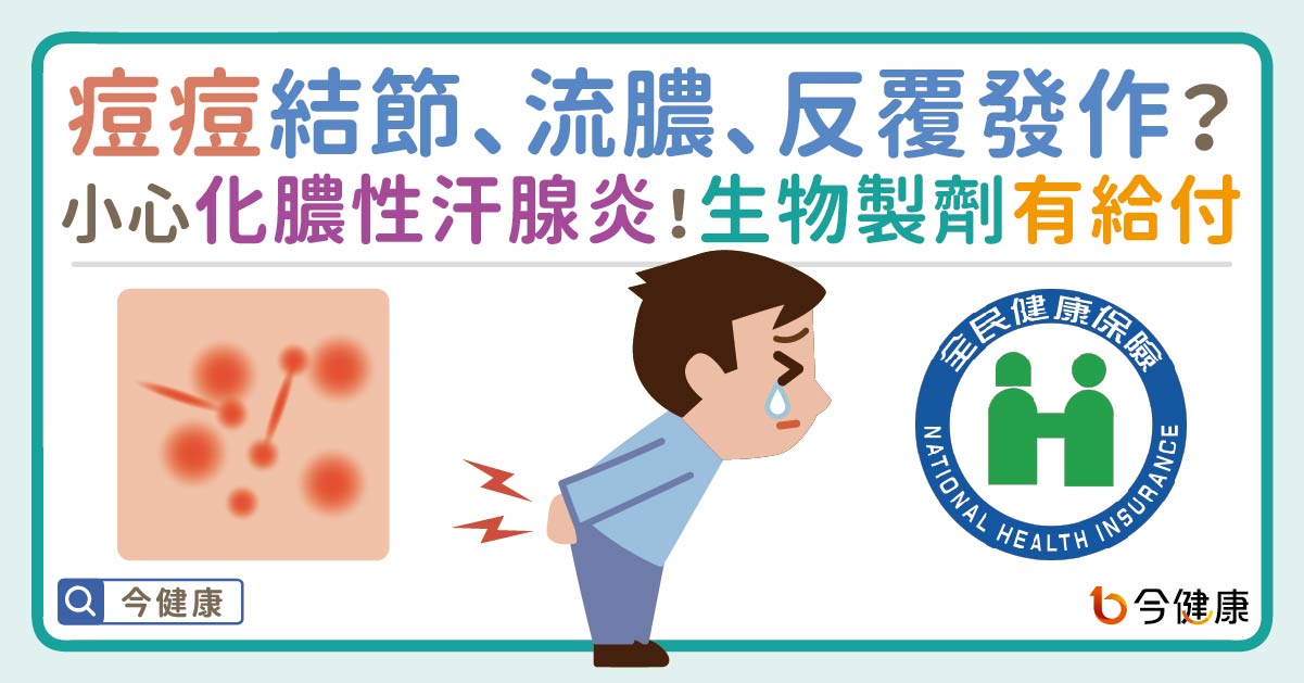 痘痘結節、流膿、反覆發作？小心化膿性汗腺炎！生物製劑有給付