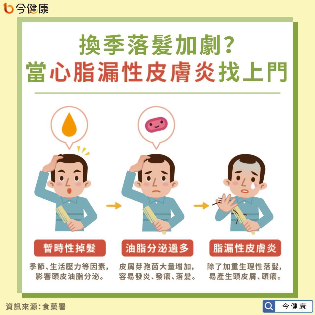 頭皮 脂 漏 性 画像 炎 皮膚