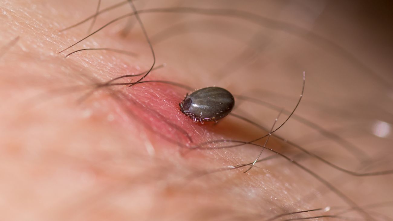 Lyme disease: the horror