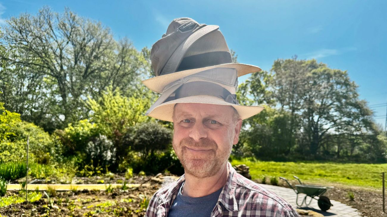 Why I Always Wear a Hat