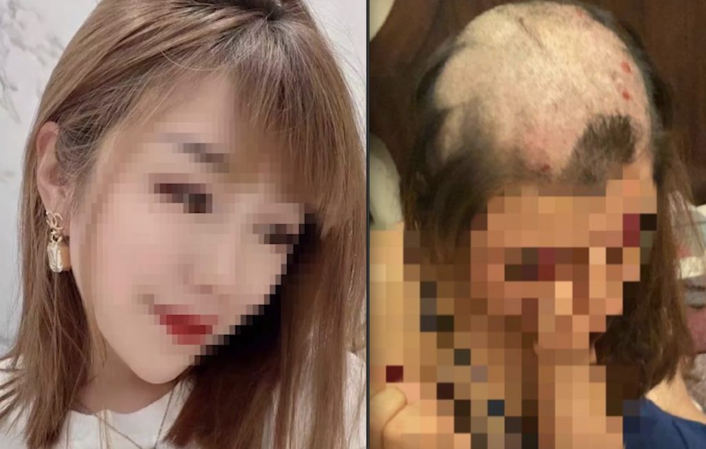 河北人妻被丈夫剃光頭髮，慘狀在網路上瘋傳。（圖／翻攝自極目新聞微博）