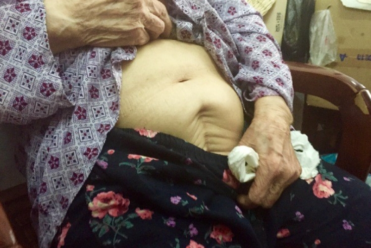 大陸慰安婦被軍人捅一刀導致無法生育。(圖/翻攝自侵華日軍南京大屠殺遇難同胞紀念館微博)
