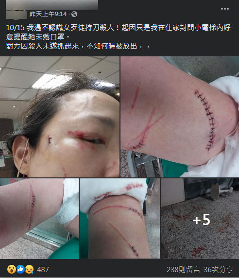 台北中山區一名女子遭住戶拿美工刀砍傷。（圖／取自當事人臉書）