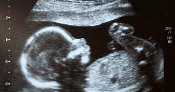 英國倫敦一名曾流產過的2寶媽，近日終於又懷上第3胎，不料在照超音波時卻發現，母胎中竟還出現一張人臉，她也對此堅信，這一定是過去流掉的孩子又回來了。（示意圖／pixabay）