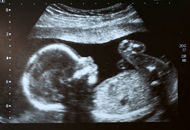 英國倫敦一名曾流產過的2寶媽，近日終於又懷上第3胎，不料在照超音波時卻發現，母胎中竟還出現一張人臉，她也對此堅信，這一定是過去流掉的孩子又回來了。（示意圖／pixabay）