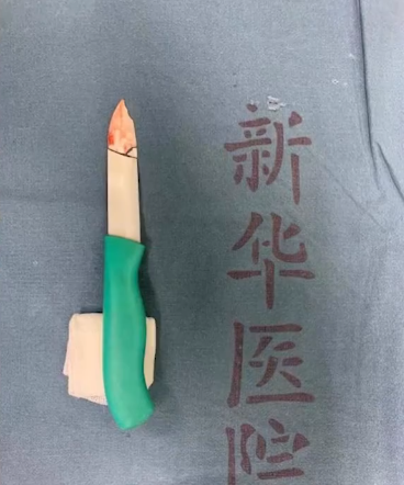 醫師手術後取出4cm的刀片。(圖/翻攝自微博)