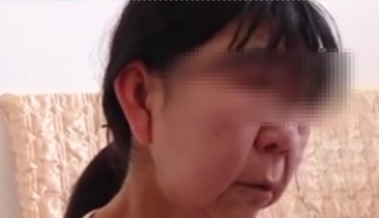 14歲少女罹患「怪病」。（圖／翻攝自「民生頻道」微博）